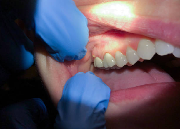 Best Walk-In Emergency Dentist in Charlevoix, MI
