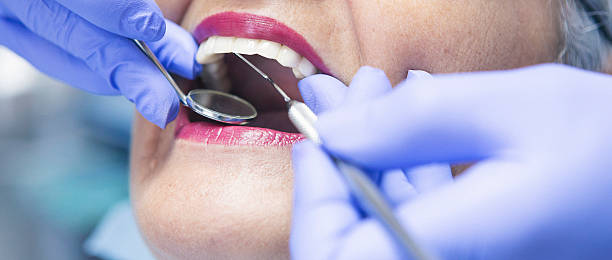 Best Emergency Tooth Extraction in Charlevoix, MI